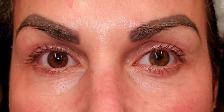 Facial Esthetics After 2