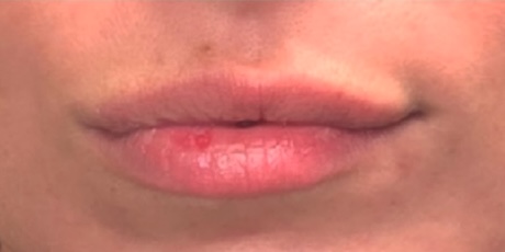 Facial Esthetics Before 1